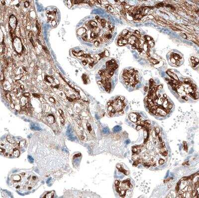 Immunohistochemistry-Paraffin: Integrin alpha 1/CD49a Antibody (CL7217) [NBP2-76479]
