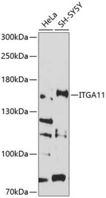 Western Blot: Integrin alpha 11 AntibodyBSA Free [NBP3-03823]