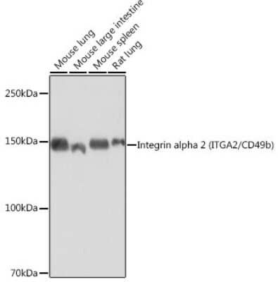 Western Blot: Integrin alpha 2/CD49b Antibody (7O9H6) [NBP3-15644]