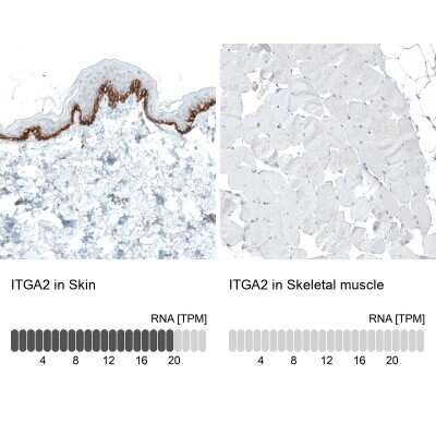 Immunohistochemistry-Paraffin: Integrin alpha 2/CD49b Antibody (CL7318) [NBP2-76483]