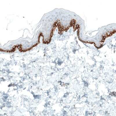 Immunohistochemistry-Paraffin: Integrin alpha 2/CD49b Antibody (CL7318) [NBP2-76483]