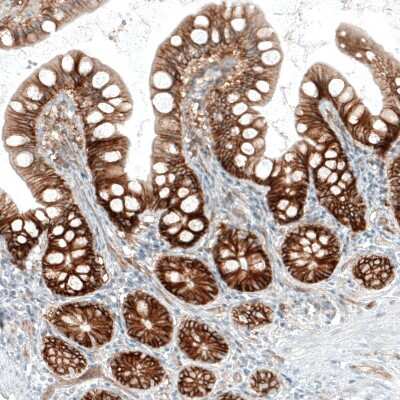 Immunohistochemistry-Paraffin: Integrin alpha 2/CD49b Antibody (CL7318) [NBP2-76483]