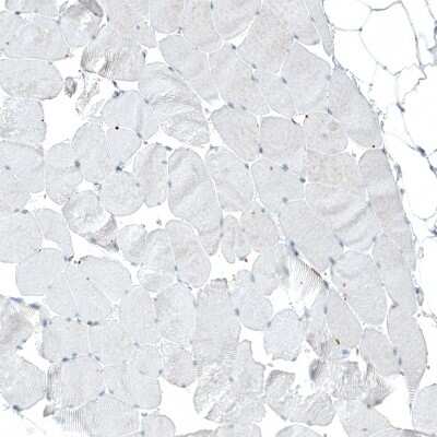 Immunohistochemistry-Paraffin: Integrin alpha 2/CD49b Antibody (CL7318) [NBP2-76483]