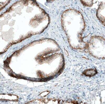 Immunohistochemistry-Paraffin: Integrin alpha 2/CD49b Antibody (CL7318) [NBP2-76483]