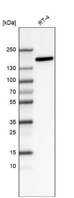 Western Blot: Integrin alpha 2/CD49b Antibody (CL7318) [NBP2-76483]
