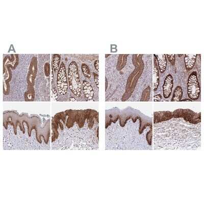 Immunohistochemistry-Paraffin: Integrin alpha 2/CD49b Antibody [NBP2-38902]