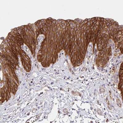 Immunohistochemistry-Paraffin: Integrin alpha 2/CD49b Antibody [NBP2-38902]