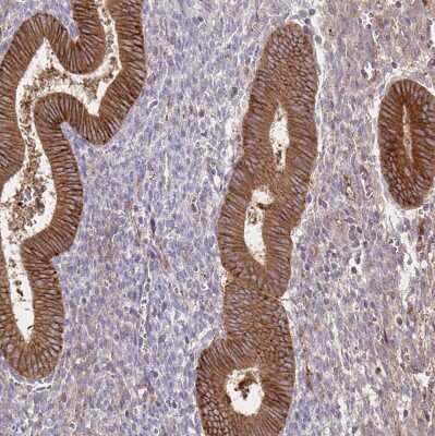 Immunohistochemistry-Paraffin: Integrin alpha 2/CD49b Antibody [NBP2-38902]