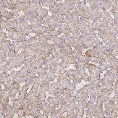 Immunohistochemistry-Paraffin: Integrin alpha 2/CD49b Antibody [NBP2-38902]