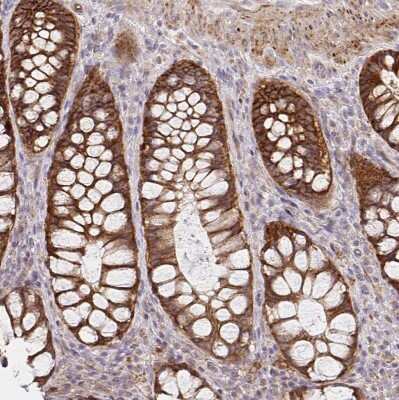 Immunohistochemistry-Paraffin: Integrin alpha 2/CD49b Antibody [NBP2-38902]