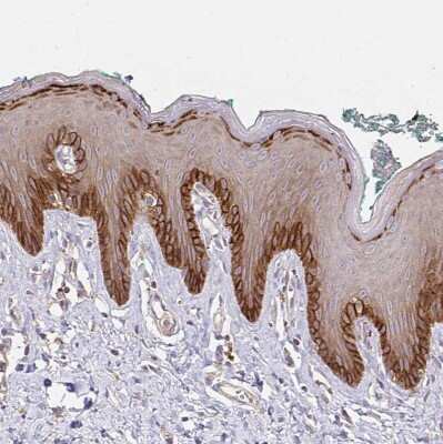Immunohistochemistry-Paraffin: Integrin alpha 2/CD49b Antibody [NBP2-38902]