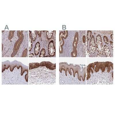 Immunohistochemistry-Paraffin: Integrin alpha 2/CD49b Antibody [NBP2-38995]