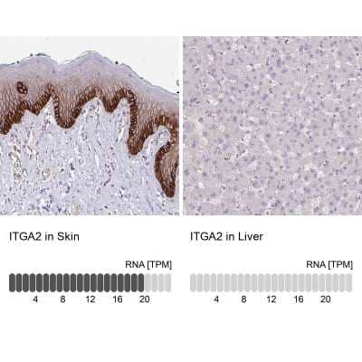 Immunohistochemistry-Paraffin: Integrin alpha 2/CD49b Antibody [NBP2-38995]