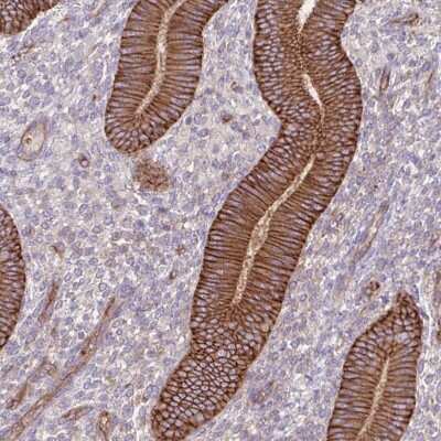 Immunohistochemistry-Paraffin: Integrin alpha 2/CD49b Antibody [NBP2-38995]
