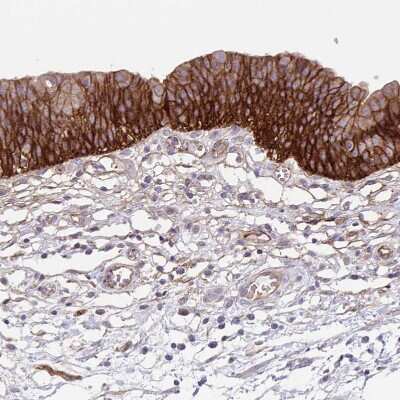 Immunohistochemistry-Paraffin: Integrin alpha 2/CD49b Antibody [NBP2-38995]