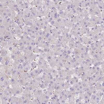 Immunohistochemistry-Paraffin: Integrin alpha 2/CD49b Antibody [NBP2-38995]