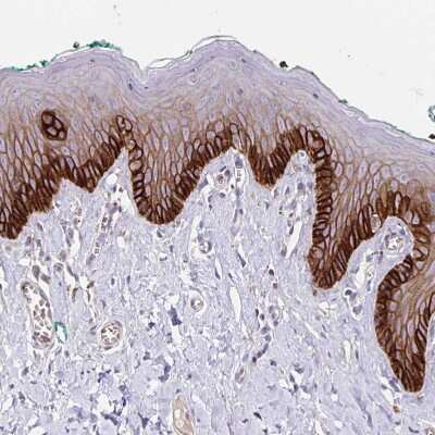 Immunohistochemistry-Paraffin: Integrin alpha 2/CD49b Antibody [NBP2-38995]
