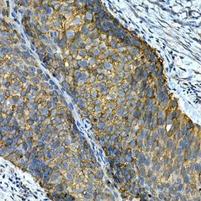 Immunohistochemistry-Paraffin: Integrin alpha 2/CD49b Antibody - Azide and BSA Free [NBP3-03851]