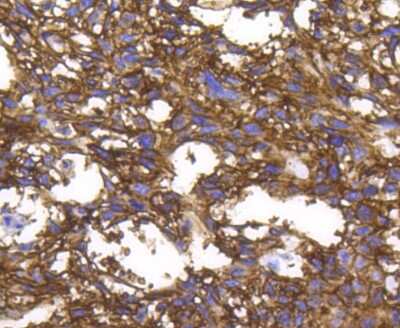 Immunohistochemistry-Paraffin: Integrin alpha 2/CD49b Antibody (SN0752) [NBP2-67691]
