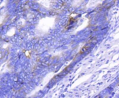 Immunohistochemistry-Paraffin: Integrin alpha 2/CD49b Antibody (SN0752) [NBP2-67691]