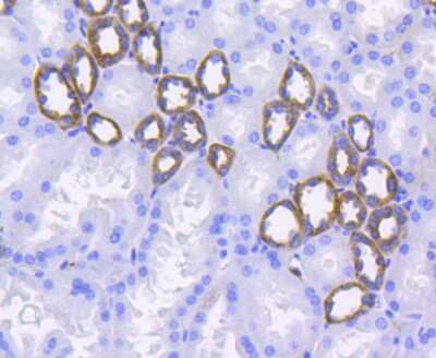 Immunohistochemistry-Paraffin: Integrin alpha 2/CD49b Antibody (SN0752) [NBP2-67691]