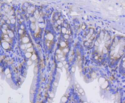 Immunohistochemistry-Paraffin: Integrin alpha 2/CD49b Antibody (SN0752) [NBP2-67691]