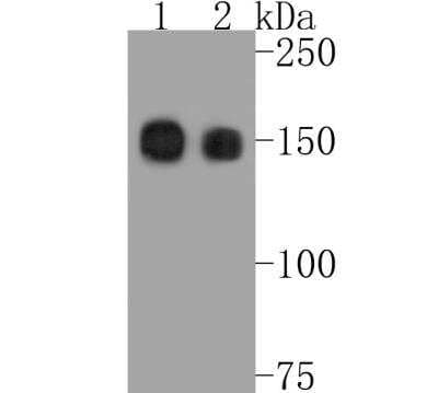 Western Blot: Integrin alpha 2/CD49b Antibody (SN0752) [NBP2-67691]