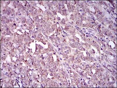 Immunohistochemistry: Integrin alpha 2b/CD41 Antibody (2E10C9) - BSA Free [NBP2-37384]