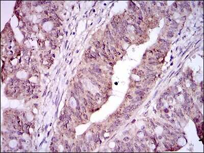 Immunohistochemistry: Integrin alpha 2b/CD41 Antibody (2E10C9) - BSA Free [NBP2-37384]