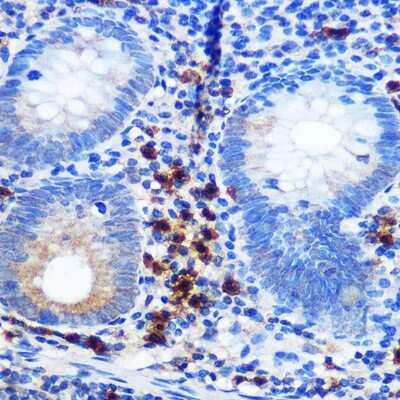 Immunohistochemistry-Paraffin: Integrin alpha 2b/CD41 Antibody (6Q5C2) [NBP3-15392]