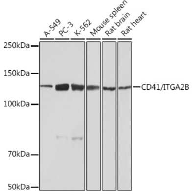 Western Blot: Integrin alpha 2b/CD41 Antibody (6Q5C2) [NBP3-15392]