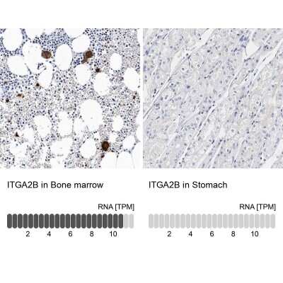 Immunohistochemistry-Paraffin: Integrin alpha 2b/CD41 Antibody [NBP1-84579]