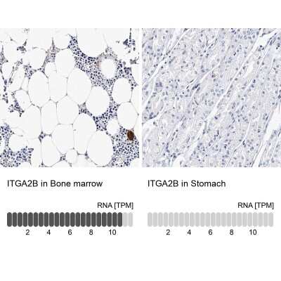 Immunohistochemistry-Paraffin: Integrin alpha 2b/CD41 Antibody [NBP1-84580]