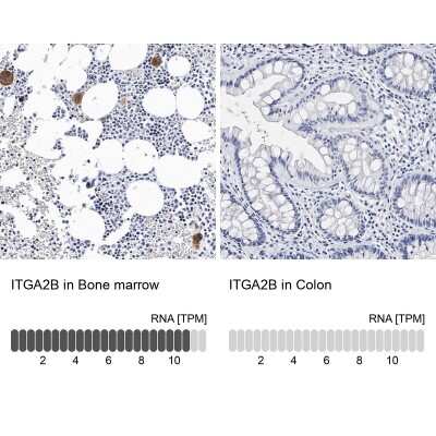 Immunohistochemistry-Paraffin: Integrin alpha 2b/CD41 Antibody [NBP1-84581]