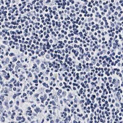 Immunohistochemistry-Paraffin: Integrin alpha 2b/CD41 Antibody [NBP1-84582]