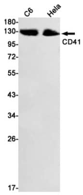 Western Blot: Integrin alpha 2b/CD41 Antibody (S01-1C2) [NBP3-20022]