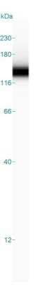 Simple Western: Integrin alpha 2b/CD41 Antibody [NBP1-84581]