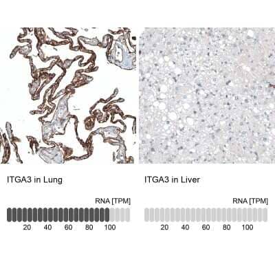 Immunohistochemistry-Paraffin: Integrin alpha 3/CD49c Antibody (CL6937) [NBP2-76515]