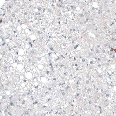 Immunohistochemistry-Paraffin: Integrin alpha 3/CD49c Antibody (CL6937) [NBP2-76515]