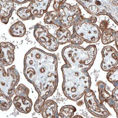 Immunohistochemistry-Paraffin: Integrin alpha 3/CD49c Antibody (CL6937) [NBP2-76515]