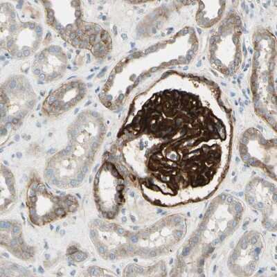 Immunohistochemistry-Paraffin: Integrin alpha 3/CD49c Antibody [NBP2-48514]