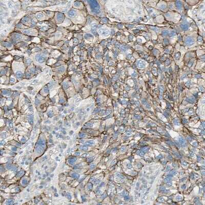 Immunohistochemistry-Paraffin: Integrin alpha 3/CD49c Antibody [NBP2-48514]