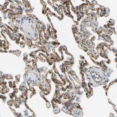 Immunohistochemistry-Paraffin: Integrin alpha 3/CD49c Antibody [NBP2-48514]