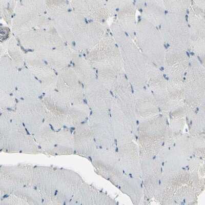 Immunohistochemistry-Paraffin: Integrin alpha 3/CD49c Antibody [NBP2-48514]