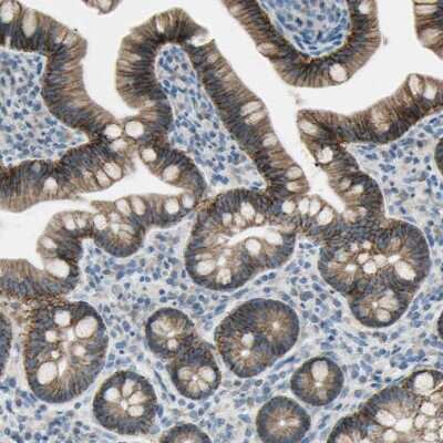 Immunohistochemistry-Paraffin: Integrin alpha 3/CD49c Antibody [NBP2-48514]