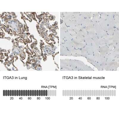 Immunohistochemistry-Paraffin: Integrin alpha 3/CD49c Antibody [NBP2-48514]