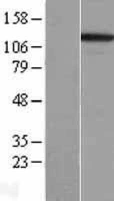 Western Blot: Integrin alpha 3/CD49c Overexpression Lysate [NBL1-12063]