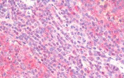 Immunohistochemistry-Paraffin: Integrin alpha 4/CD49d Antibody - BSA Free [NB110-55525]