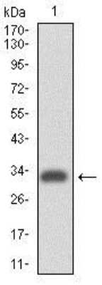 Western Blot: Integrin alpha 4/CD49d Antibody (5C4)BSA Free [NBP2-37503]