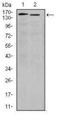 Western Blot: Integrin alpha 4/CD49d Antibody (5C4)BSA Free [NBP2-37503]